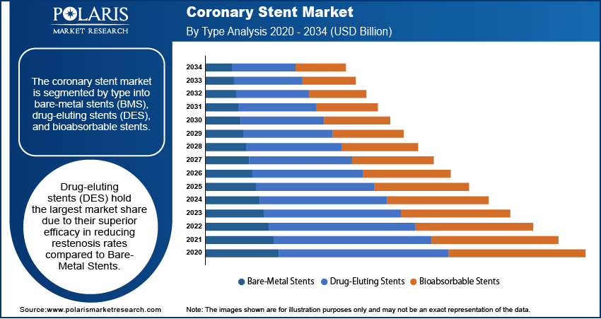 Coronary Stent Market Growth